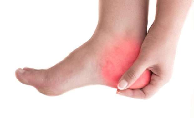 heelPain001